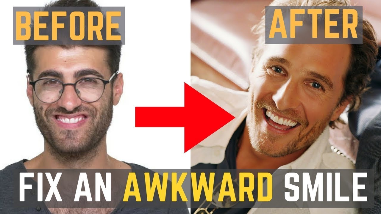 How to FIX an AWKWARD Smile | Develop a MAGNETIC Smile Women Will Love
